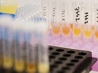 Образцы мочи, взятые для пробы на допинг Образцы мочи, взятые для пробы на допинг
