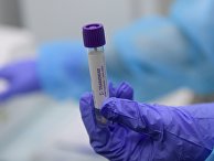 "Гемотест" начинает делать анализы на коронавирусную инфекцию "Гемотест" начинает делать анализы на коронавирусную инфекцию
