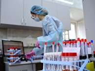 Тестирование на COVID-19 в лаборатории НИИ Склифосовского Тестирование на COVID-19 в лаборатории НИИ Склифосовского