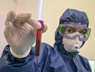 Экспресс-диагностика на антитела к коронавирусу в клинике Hadassah Medical Moscow в Сколково Экспресс-диагностика на антитела к коронавирусу в клинике Hadassah Medical Moscow в Сколково